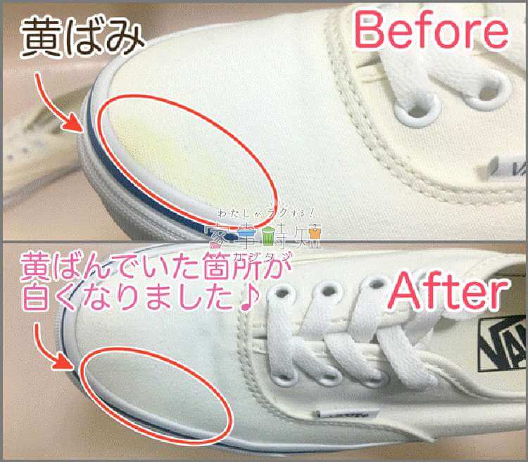 before after